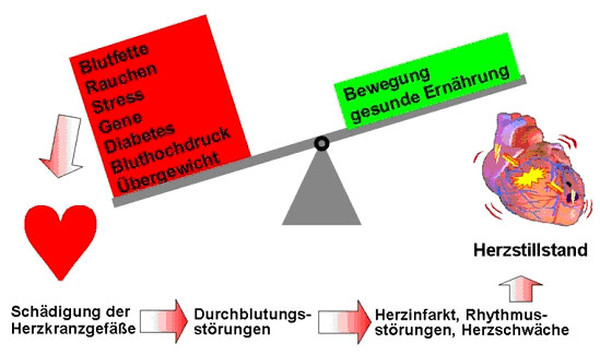 Herzinfarkt